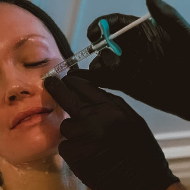 Photo of SkinVive™ by Juvéderm®